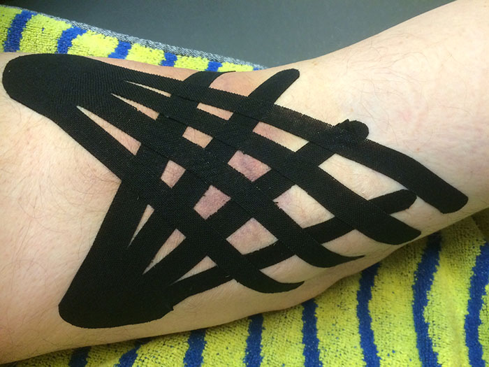 Foto behandeling Medical Taping Concept / Kinesiotape